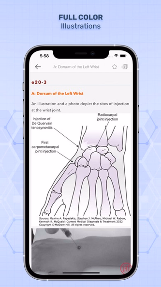 CURRENT Med Diag & Treatment Screenshot 3 - AppWisp.com CURRENT Med Diag & Treatment Screenshot 3 - AppWisp.com