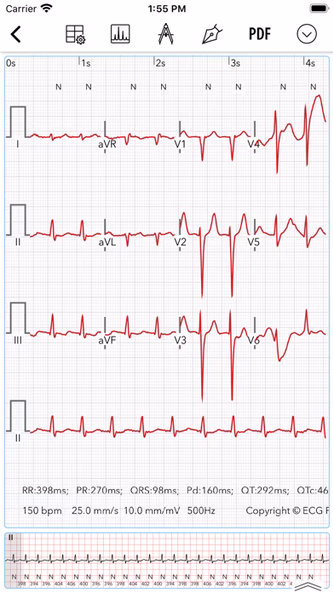 ECG for Doctors Screenshot 3 - AppWisp.com ECG for Doctors Screenshot 3 - AppWisp.com