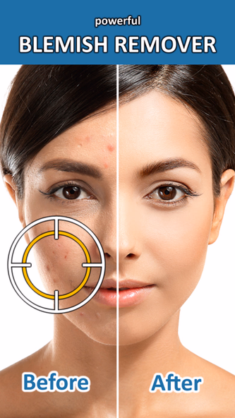 Blemish Remover Photo Tool Screenshot 1 - AppWisp.com Blemish Remover Photo Tool Screenshot 1 - AppWisp.com