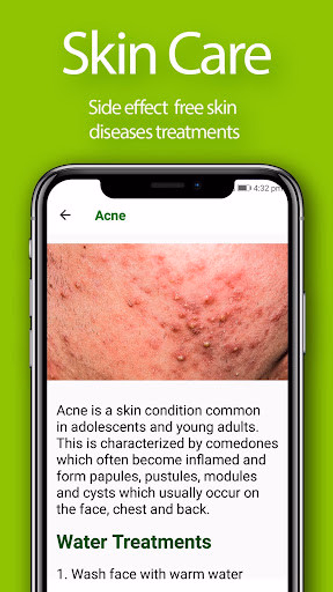 Herbal Home Remedies and Natur Screenshot 2 - AppWisp.com Herbal Home Remedies and Natur Screenshot 2 - AppWisp.com