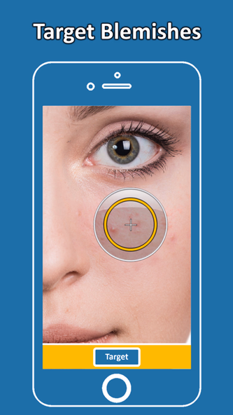 Blemish Remover Photo Tool Screenshot 2 - AppWisp.com Blemish Remover Photo Tool Screenshot 2 - AppWisp.com