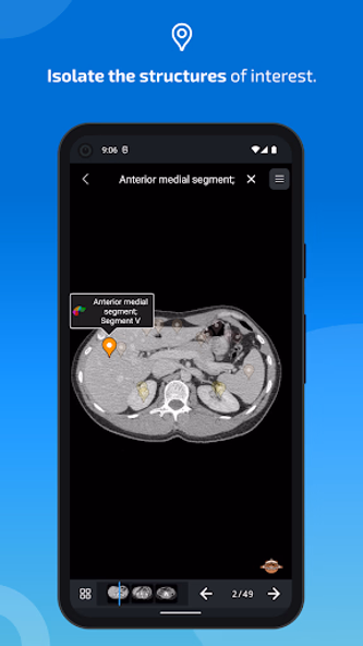 e-Anatomy Screenshot 4 - AppWisp.com e-Anatomy Screenshot 4 - AppWisp.com