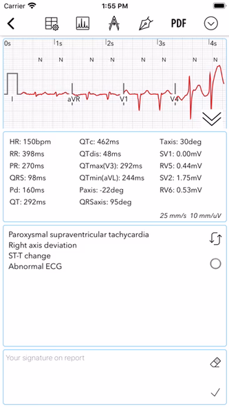ECG for Doctors Screenshot 4 - AppWisp.com ECG for Doctors Screenshot 4 - AppWisp.com