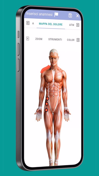 OsteoEasy Screenshot 1 - AppWisp.com OsteoEasy Screenshot 1 - AppWisp.com