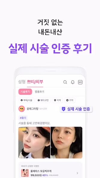 바비톡 - 800만이 선택한 대표 성형/시술 플랫폼 Screenshot 2 - AppWisp.com