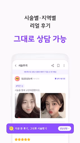 바비톡 - 800만이 선택한 대표 성형/시술 플랫폼 Screenshot 3 - AppWisp.com