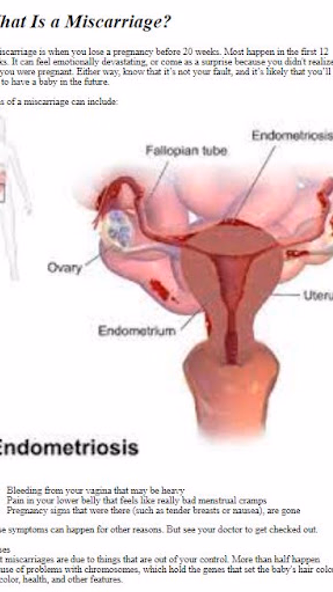 Early Pregnancy Loss Guide Screenshot 3 - AppWisp.com Early Pregnancy Loss Guide Screenshot 3 - AppWisp.com