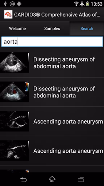 CARDIO3® ECHO - Lite Screenshot 4 - AppWisp.com CARDIO3® ECHO - Lite Screenshot 4 - AppWisp.com
