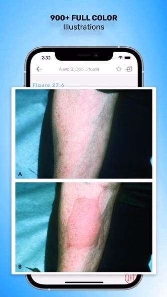 Goodheart Skin Disorders Screenshot 4 - AppWisp.com Goodheart Skin Disorders Screenshot 4 - AppWisp.com
