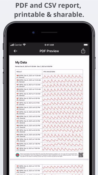 Heart Rate Plus: Pulse Monitor Screenshot 3 - AppWisp.com Heart Rate Plus: Pulse Monitor Screenshot 3 - AppWisp.com