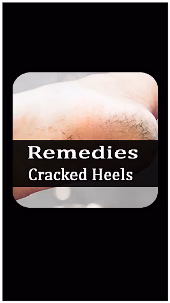 Remedies for cracked heels – e Screenshot 1 - AppWisp.com Remedies for cracked heels – e Screenshot 1 - AppWisp.com