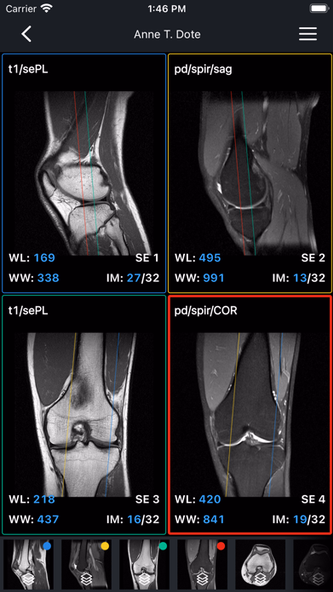 IDV - IMAIOS DICOM Viewer Screenshot 3 - AppWisp.com IDV - IMAIOS DICOM Viewer Screenshot 3 - AppWisp.com