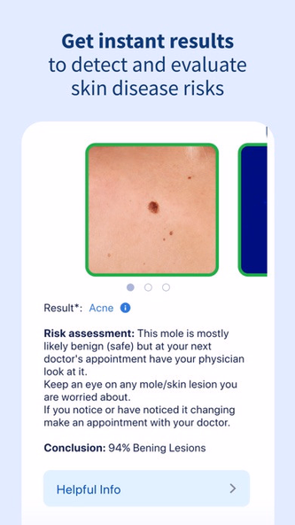 AI Dermatologist: Skin Scanner Screenshot 4 - AppWisp.com AI Dermatologist: Skin Scanner Screenshot 4 - AppWisp.com
