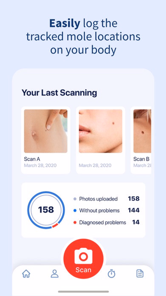 AI Dermatologist: Skin Scanner Screenshot 3 - AppWisp.com AI Dermatologist: Skin Scanner Screenshot 3 - AppWisp.com
