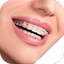 Real Braces Camera - AppWisp.com