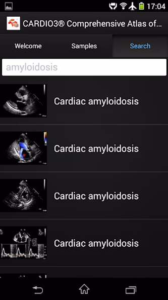 CARDIO3® ECHO - Lite Screenshot 3 - AppWisp.com CARDIO3® ECHO - Lite Screenshot 3 - AppWisp.com