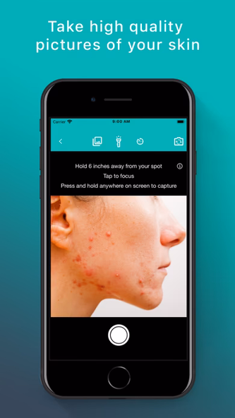 Skin App - Online Dermatology Screenshot 4 - AppWisp.com Skin App - Online Dermatology Screenshot 4 - AppWisp.com