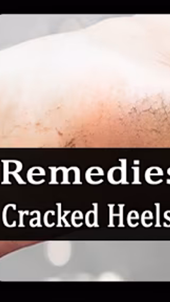 Remedies for cracked heels – e Screenshot 2 - AppWisp.com Remedies for cracked heels – e Screenshot 2 - AppWisp.com