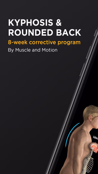 Kyphosis & Rounded Back Screenshot 1 - AppWisp.com Kyphosis & Rounded Back Screenshot 1 - AppWisp.com