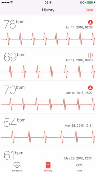 Cardiograph Screenshot 3 - AppWisp.com Cardiograph Screenshot 3 - AppWisp.com