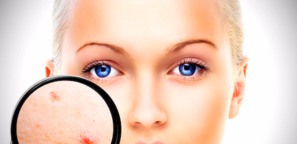 Face Enhancer: Blemish Remover Header - AppWisp.com Face Enhancer: Blemish Remover Header - AppWisp.com