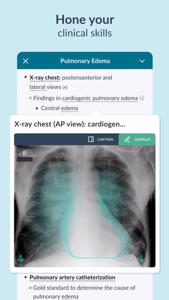AMBOSS Medical Knowledge Screenshot 3 - AppWisp.com AMBOSS Medical Knowledge Screenshot 3 - AppWisp.com
