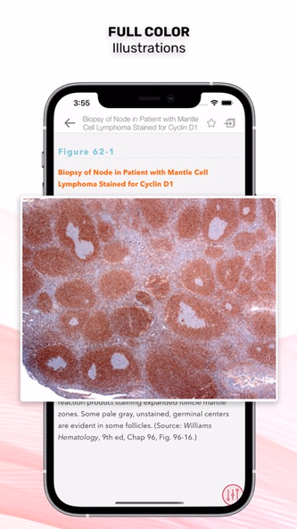 Williams Manual of Hematology Screenshot 4 - AppWisp.com Williams Manual of Hematology Screenshot 4 - AppWisp.com
