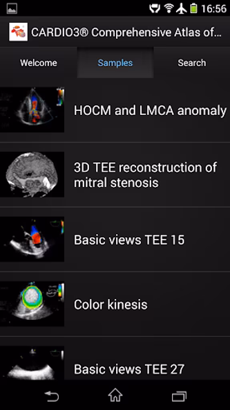 CARDIO3® ECHO - Lite Screenshot 2 - AppWisp.com CARDIO3® ECHO - Lite Screenshot 2 - AppWisp.com